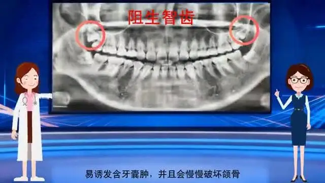 別讓智齒拖垮口腔健康！教你科學(xué)“斷舍離”，該拔該留一看就懂